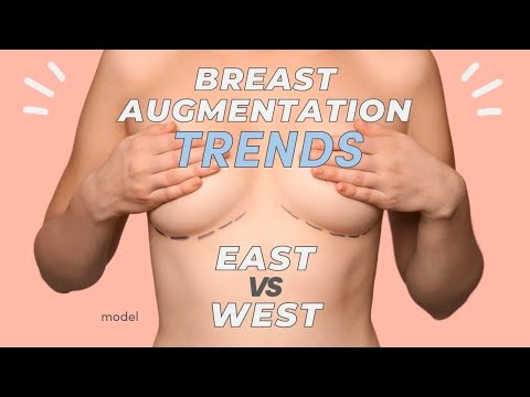 East vs. West: Comparing Breast Surgery Size Trends with Dr. Anna Steve 