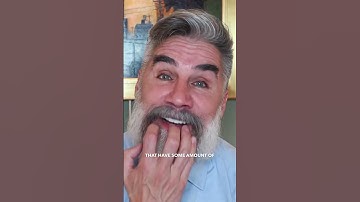 Is This A Patchy Beard Or A Common Beard Pattern? #shorts