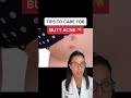 How To Get Rid of Butt Acne According to a Dermatologist #shorts