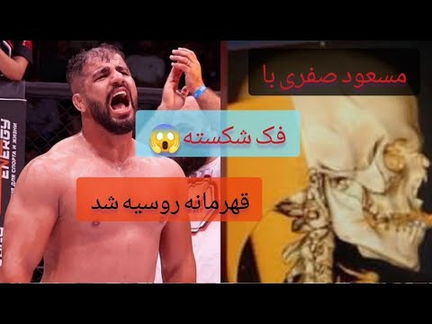 تصویری: بشریت در آستانه تراشه سازی است، آزمایش های انسانی