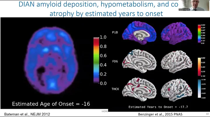Recent Updates on Blood and CSF Biomarkers and DIAN-TU Clinical Trial Status