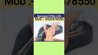 Success Ortho Ayurvedic Treatment Delivery All Over India Mob :- 9320478550 viral yt short