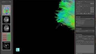 Fibers View Toolbox Demo