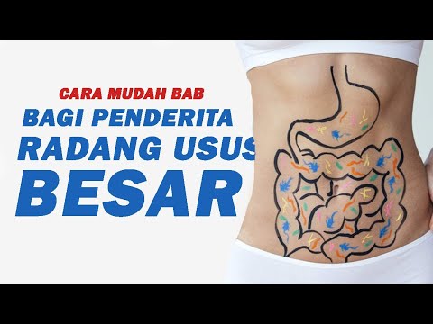 Video: Divertikulosis Usus - Gejala, Pengobatan, Diet, Komplikasi