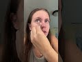 pimple patches removal #asmr #acne #skincare #satisfying #getreadywithme #usaviral #grwm #faceglow