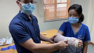 Coaptation Splint or U-Mold for forearm and wrist fractures