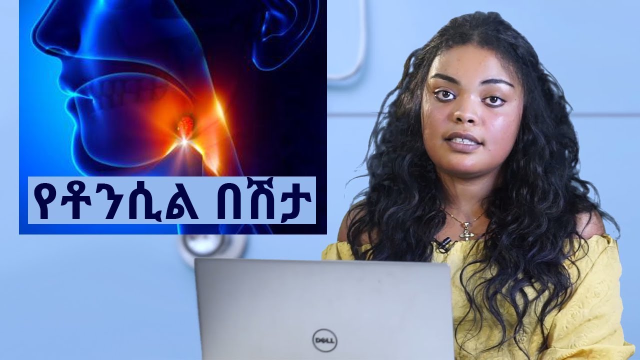 የቶንሲል በሽታ