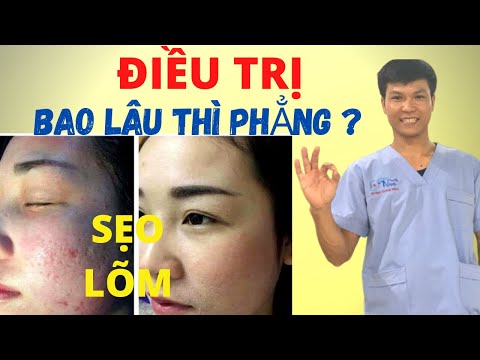 TRỊ SẸO RỖ [P2] - CÁCH NÀO CHỮA SẸO LÕM CHO BẠN -  ĐẦY SẸO sau 1 THÁNG, 3 THÁNG, 6 THÁNG | Dr Ninh