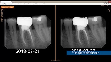 Apteryx: XVWeb 2.0 Overview