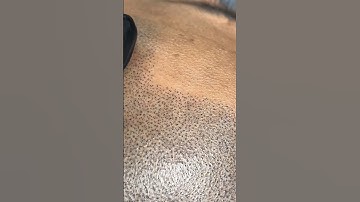 EXTREME CLOSE UP MICROPIGMENTATION #scalpmicropigmentation #hair