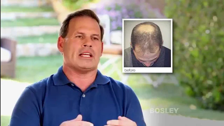 Bosley Hair Restoration Patient Testimonial | Mike K
