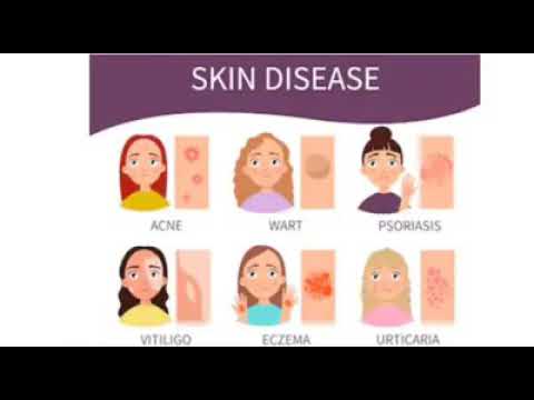 eczema meaning in bengali