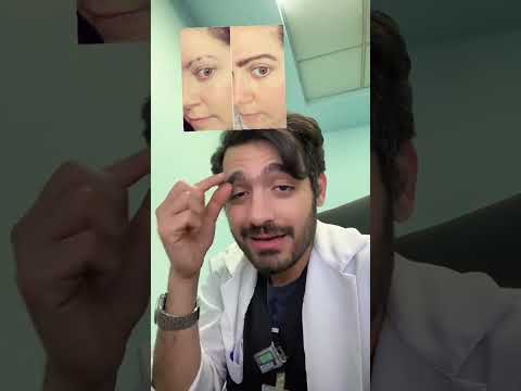 متلازمة نتف الشعر دكتور نبهان    
