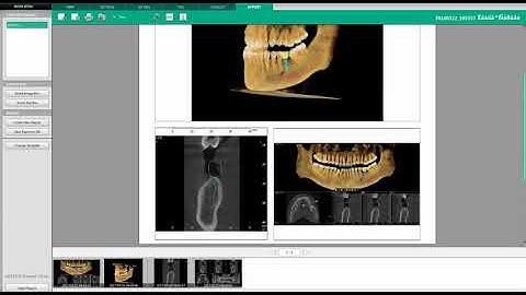 Ez3D-i | REPORT Tab | Edit and Save a Report