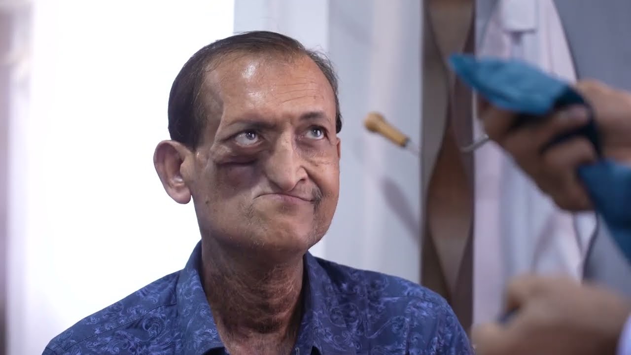 Мужчина, борющийся с раком, пришёл на консультацию по поводу пластической операции по изменению лица