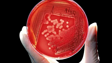 ¿Qué porcentaje de gonorrea es resistente?