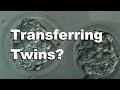 Transferring Two Embryos FET (Whole Procedure) - Wheeler IVF Journey