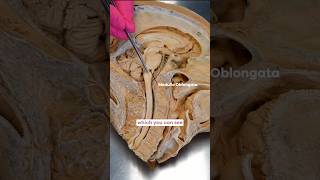 The Longest Cranial Nerve