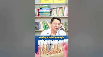 BỌC RĂNG SỨ trên IMPLANT có NIỀNG ĐƯỢC KHÔNG??? #drcuong #nhakhoa #niengrang #rangsuthammy
