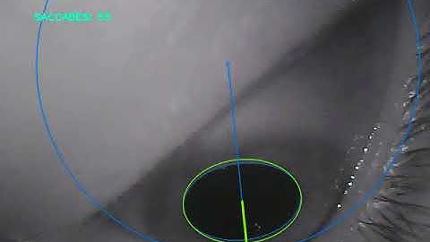 3D Eye Model Drift Correction - Real Time (HTC Vive)