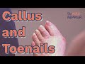 Callus and Toenails. FEET-ure Friday (2022)