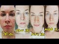 ۵ روش خانگی برای سفید کردن پوست