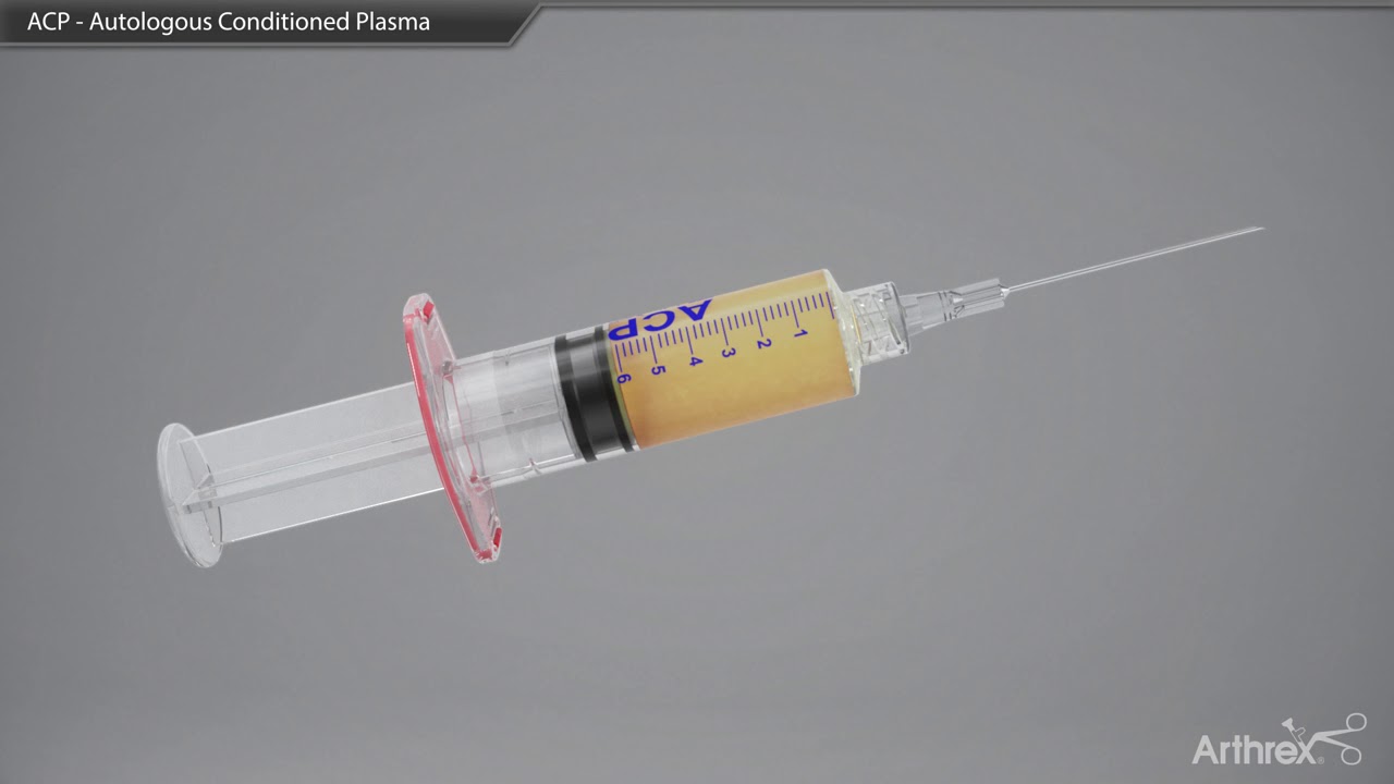 Comment se déroule une injection de