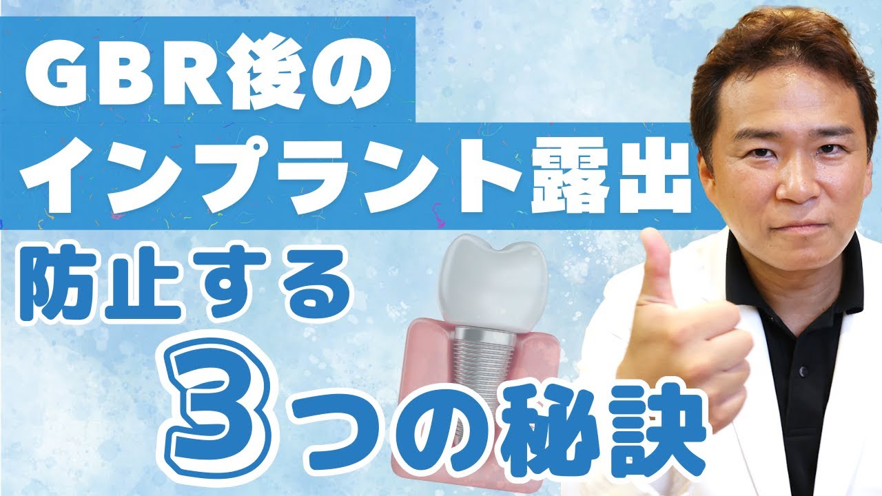 GBR後におけるボーンロスによるインプラント露出を避けるたにするべき