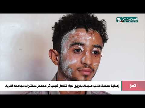هكذا أصيب خمسة طلاب صيدلة بحريق جراء تفاعل كيميائي بمعمل مختبرات بجامعة التربة تعز