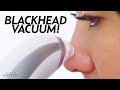 I Tried a Blackhead Remover Pore Vacuum! | Beauty with Susan Yara