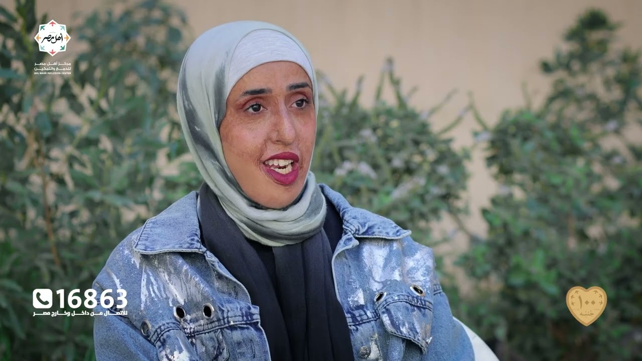 قصة ملهمة | آية تتغلب على الحروق وتبدأ رحلة التقبّل
