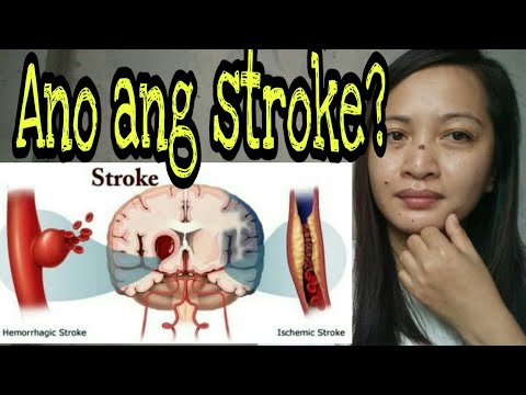 Video: Ano ang hemiplegia stroke?