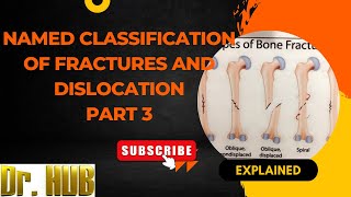 Named Clification Of Fractures And Dislocation Part 3