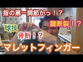 球技選手・関係者・親御様必見!マレットフィンガーについて詳しくご説明!