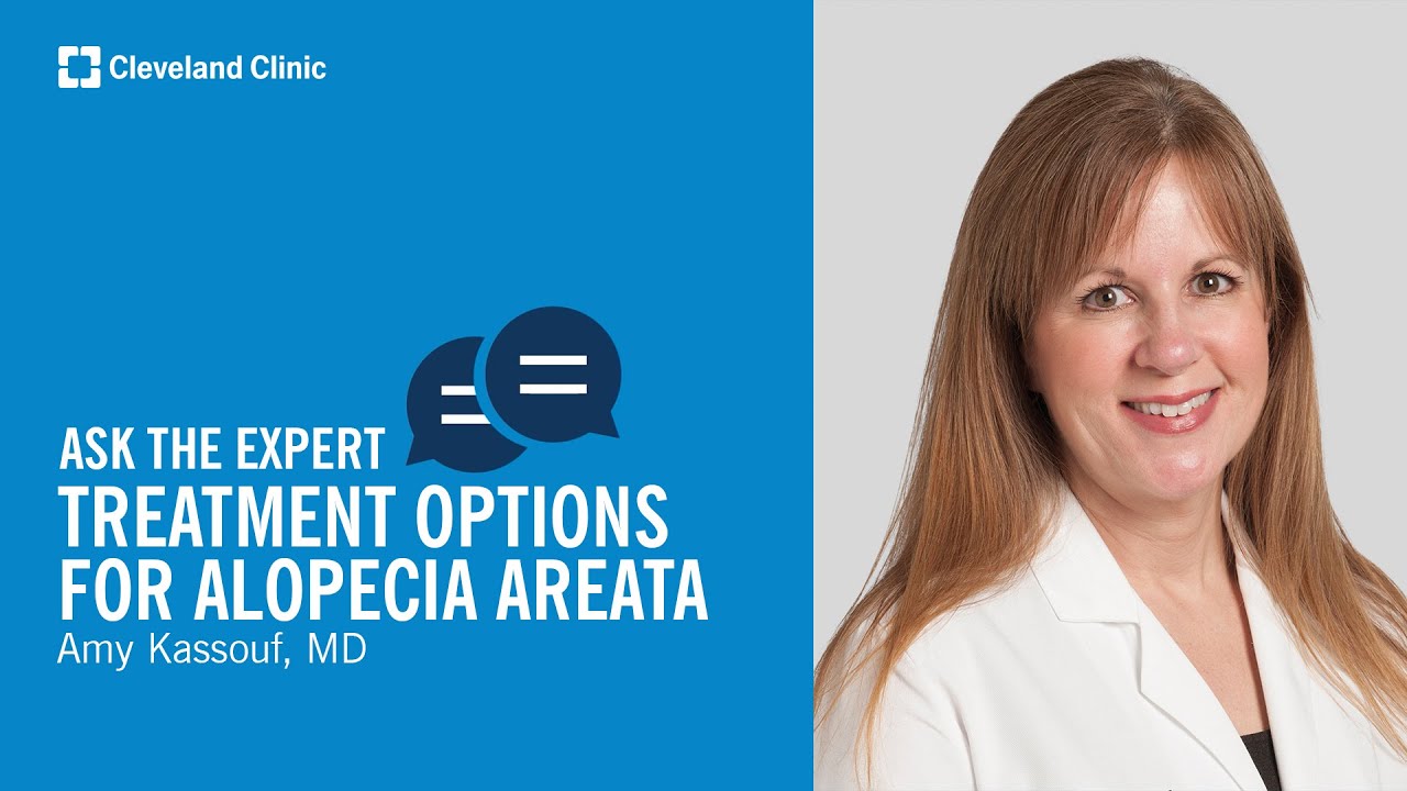 Treatment Options for Alopecia Areata | Ask Cleveland Clinics Expert