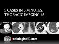 5 Cases in 5 Minutes: Thoracic #3