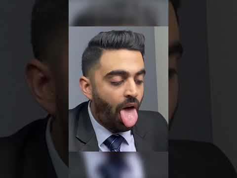 Audition Fails but Hit Ads #shorts #rahuldua