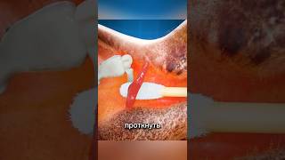 Перепонная барабанка🫨 #здоровье #медицина #факты #факт #топ #доктор #анатомия #шортс #ухо #