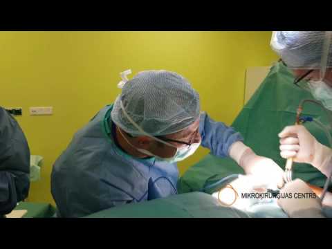 Video: Operācija - Jauna Pēcoperācijas Sāpju Mazināšanā