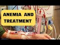 Anaemia in ckd dialysis patient and treatment