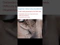 Clinical case #clinical #mbbs #aditya #neetpg #inicet #surgeryprep