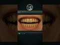 change Teeth Color in Photoshop #photoshop