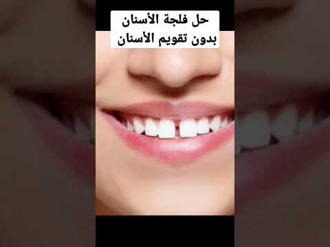 فيديو: كيفية اختيار أسنانك بدون مسواك: 6 خطوات