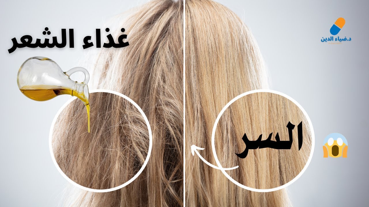 اهم عنصر غذائى لتساقط الشعر و علاج جفاف الشعر هيشان الشعر تقصف اطراف الشعر و لتنعيم الشعر