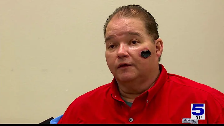 Battle with coronavirus leads to double amputation for Covid survivor