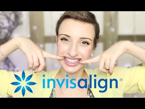 PARLONS PEU PARLONS DENTS ! Les gouttières INVISALIGN ❁