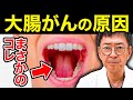 【知らないと危険】大腸がんの原因はOOだった！？腸の専門医が全て解説します