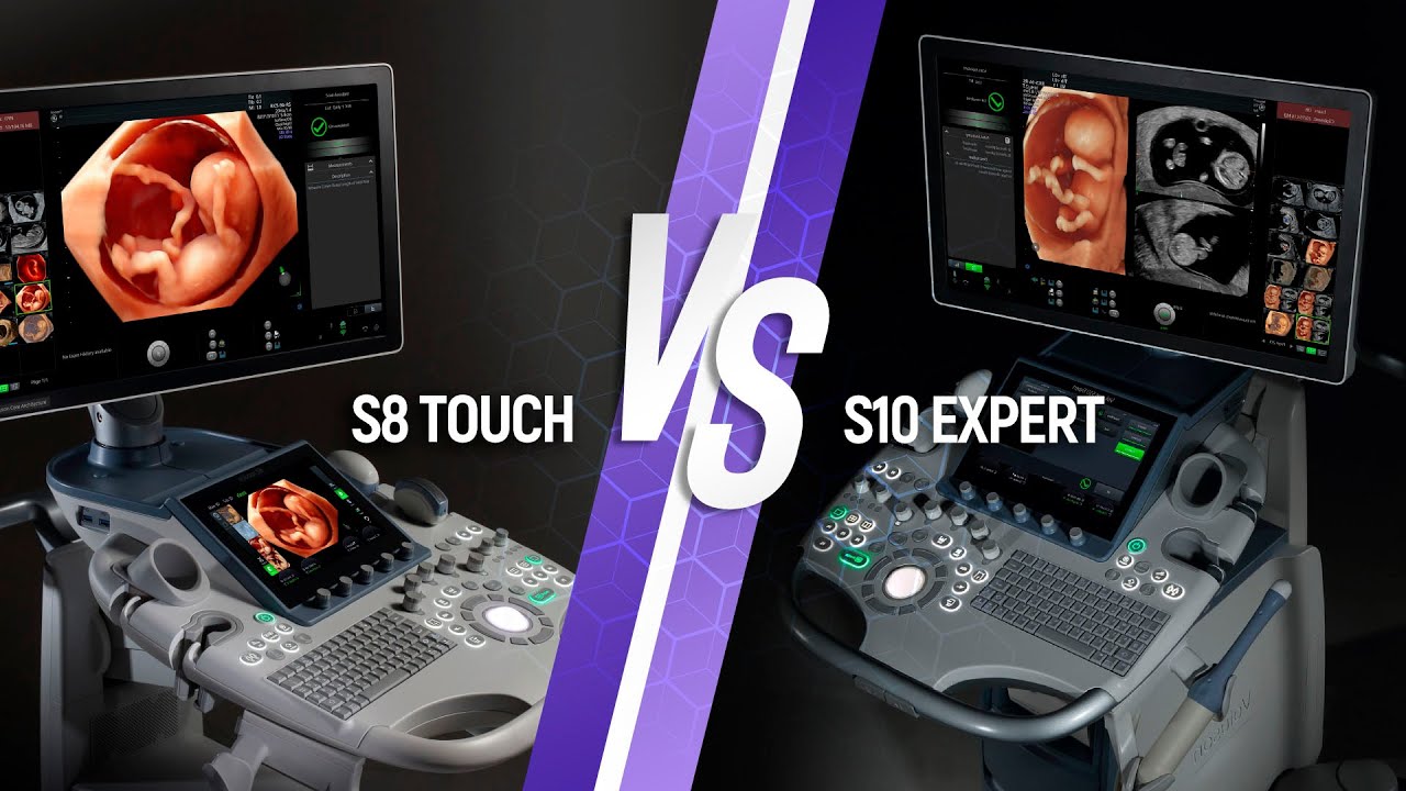 Voluson S10 Expert y Voluson S8 Touch diferencias