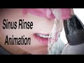 Animation de rinage des sinus