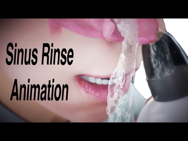 Sinus Rinse Animation class=